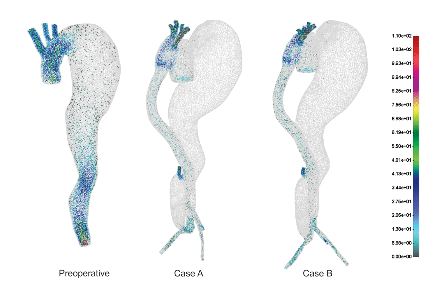 Velocity vector field for peak systolic flow within the thoracic aorta. The units are in (cm).